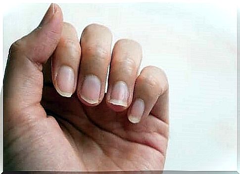 Treatments for 100% natural fragile nails