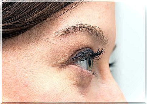 Causes and treatments for bags under the eyes