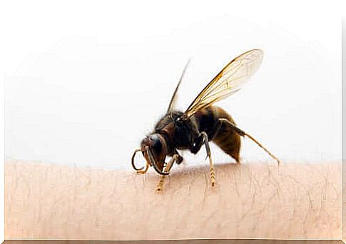 How is Asian wasp sting treated?