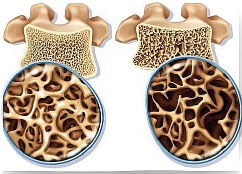 Calcium prevents osteoporosis at menopause