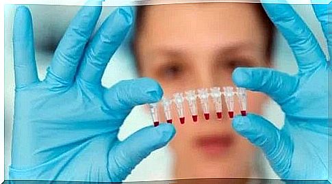 Treatment of Moebius syndrome