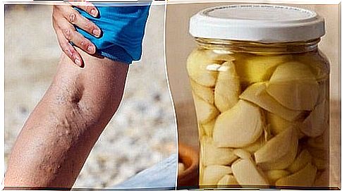 Natural remedy for varicose veins with oranges