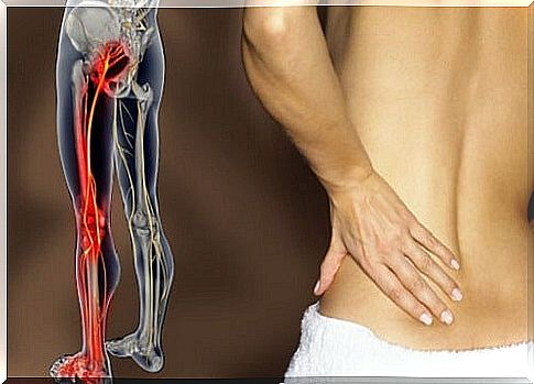 Sciatica pain can become very intense