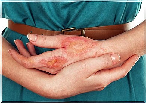 Skin cancer can be caused by an infection