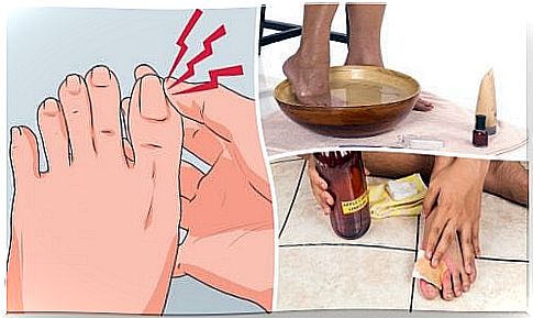 Treat ingrown toenails with 6 natural remedies