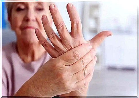 Woman with arthritis