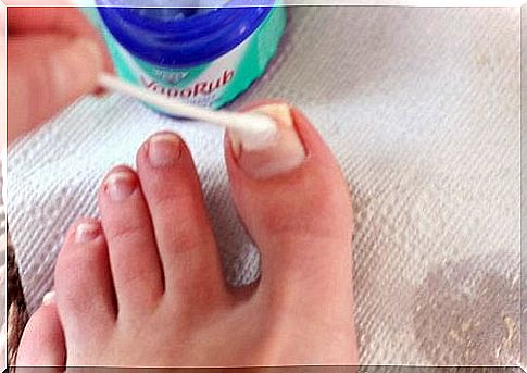 VapoRub ointment treats nail fungus