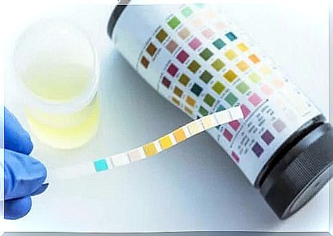 What can be detected by urine analysis?