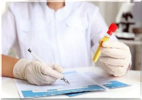 Doctor examining a urine sample