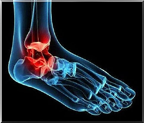 Posterior tibial tendinopathy